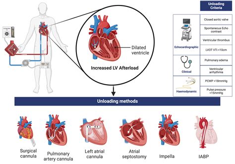 lv unloading|unloading left ventricle ecmo.